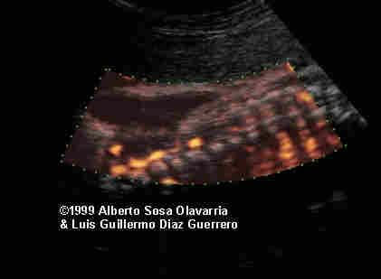 case0012-2