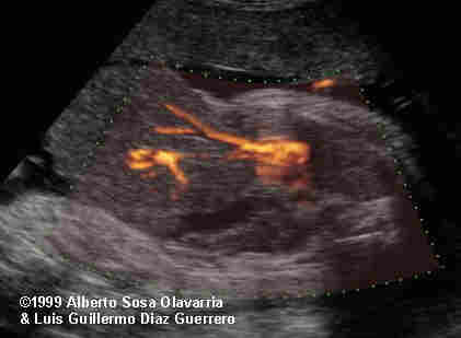 case0012-3