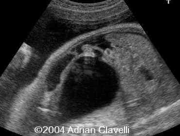 case0014-1