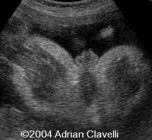 case0014-2