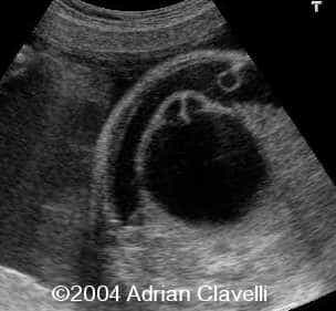 case0014-3
