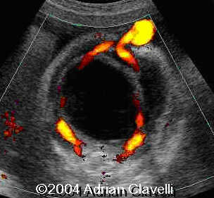 case0014-5