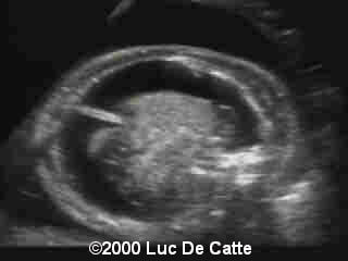 case0015-1