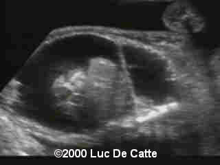 case0015-2