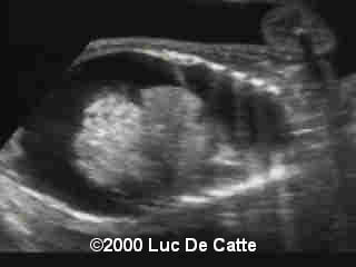 case0015-3