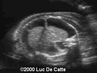 case0015-4