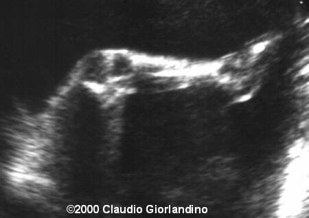 case0017-4