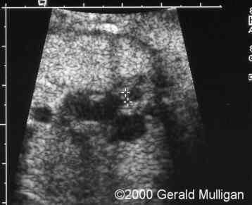 case0018_2
