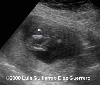case0019-5