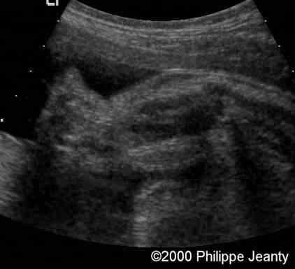 case0020-1