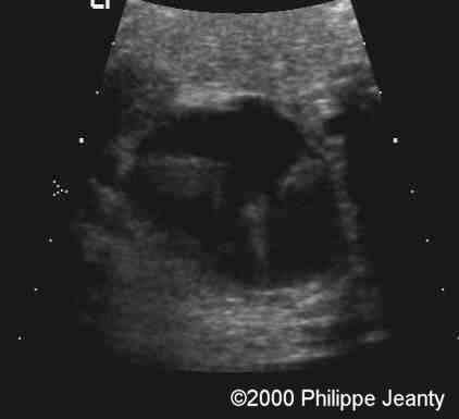 case0020-10a