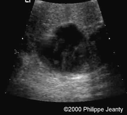 case0020-10b