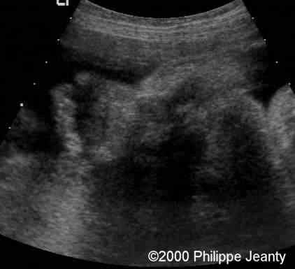 case0020-4