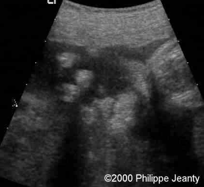case0020-4b