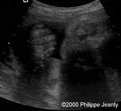 case0020-5