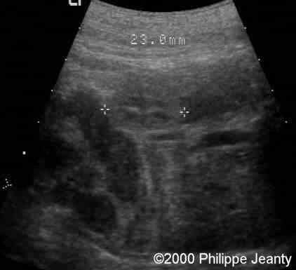 case0020-6a