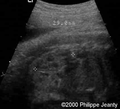 case0020-6b