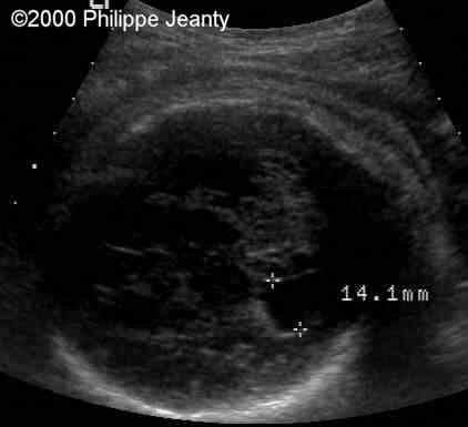 case0020-7