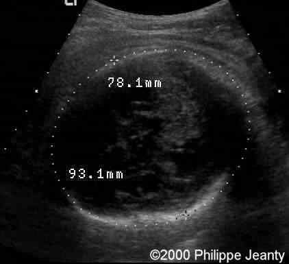 case0020-8