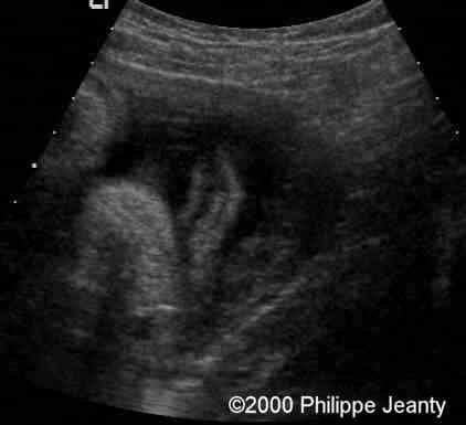 case0020-9