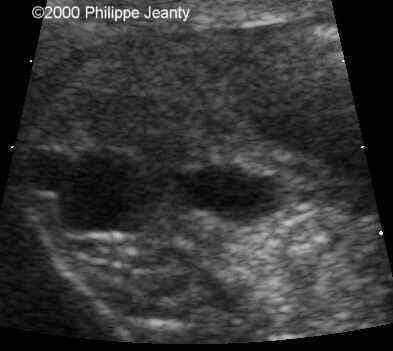case0021-11