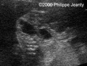 case0021-12