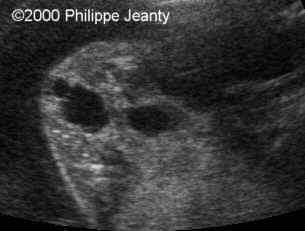 case0021-13