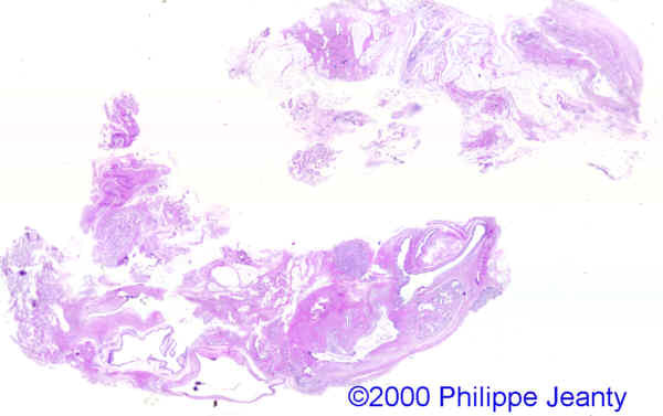 case0021-16
