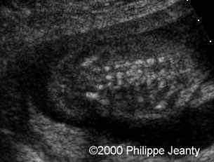 case0021-5
