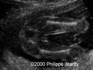 case0021-6