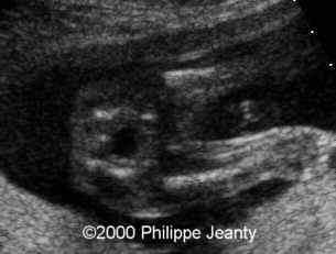 case0021-7