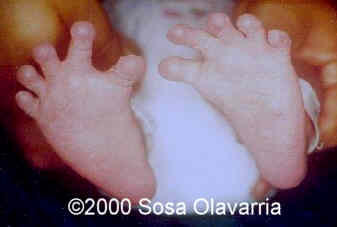 case0022-13