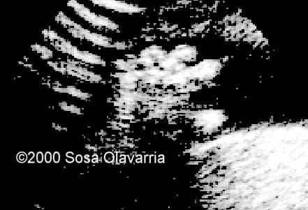 case0022-2