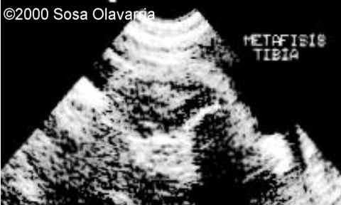 case0022-3