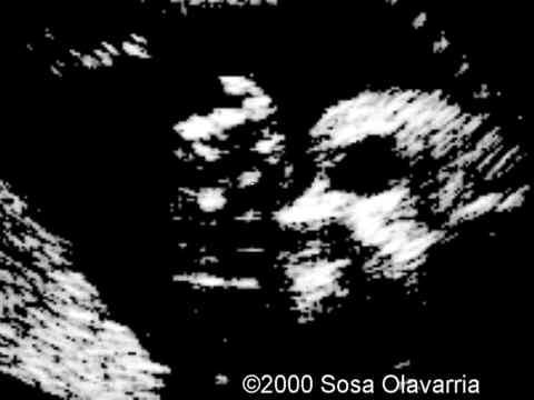 case0022-4