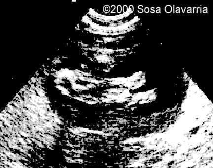 case0022-5