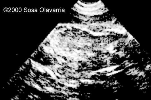 case0022-6