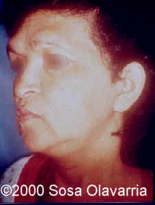 case0022-8