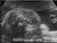 case0025-1