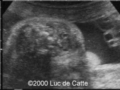 case0025-2