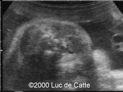 case0025-3