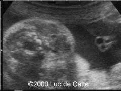 case0025-5