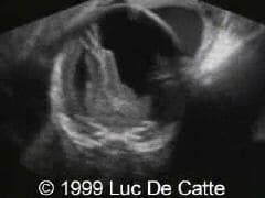 case0027-2