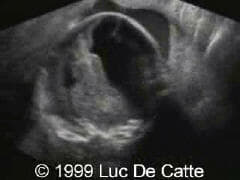 case0027-4