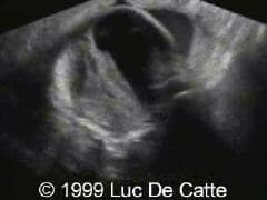 case0027-6