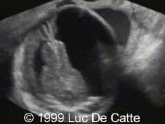 case0027-7