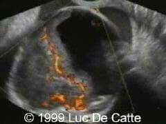 case0027-8