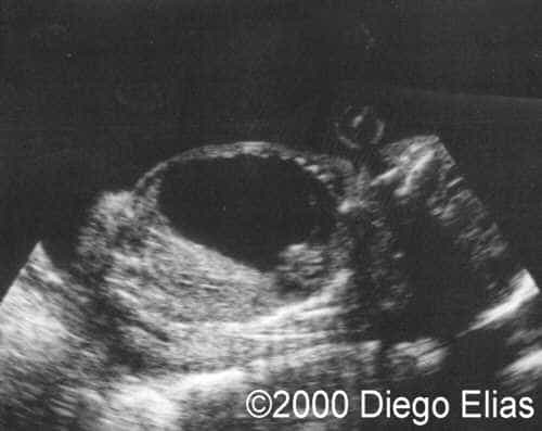 case0029-1