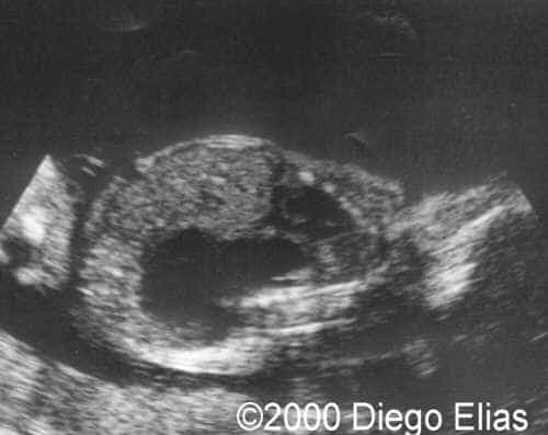 case0029-3