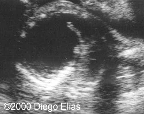 case0029-4